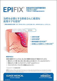 EPIFIX Product Sheet